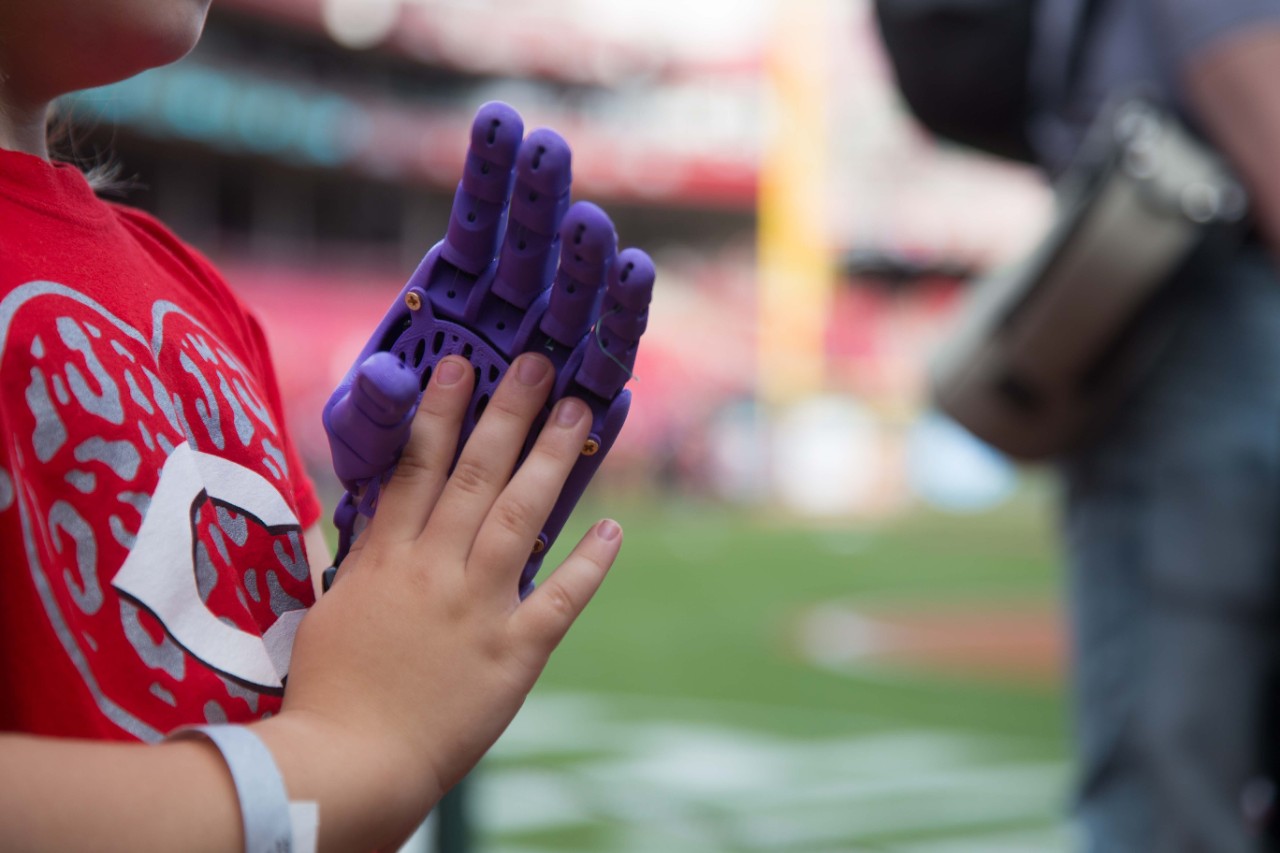 A closeup of Ella's prosthetic hand and her right hand.