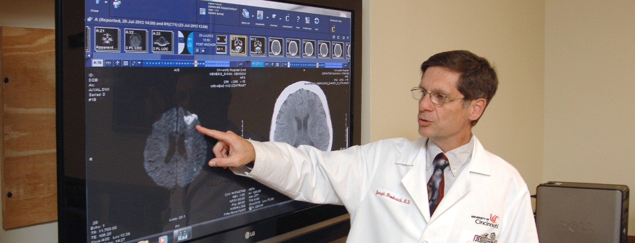 Joseph Broderick, MD, director of the UC Gardner Neuroscience Institute