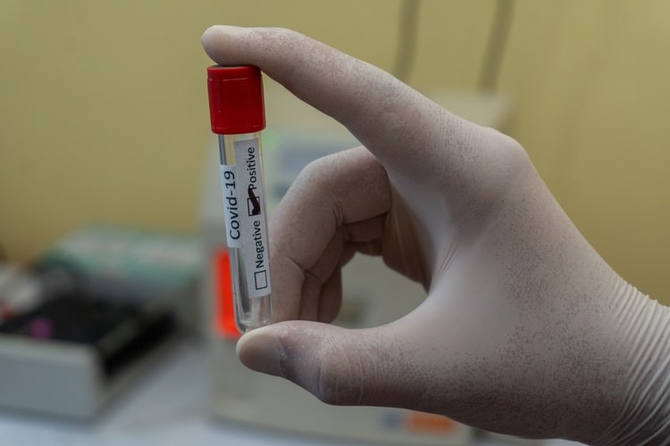 A test tube being held by someone's thumb and forefinger