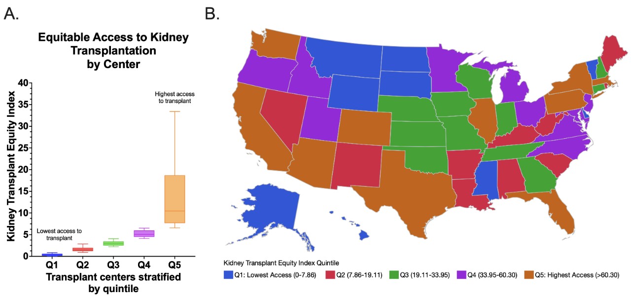 Color-coded chart of the United States showing state-by-state rankings of access to kidney transplant