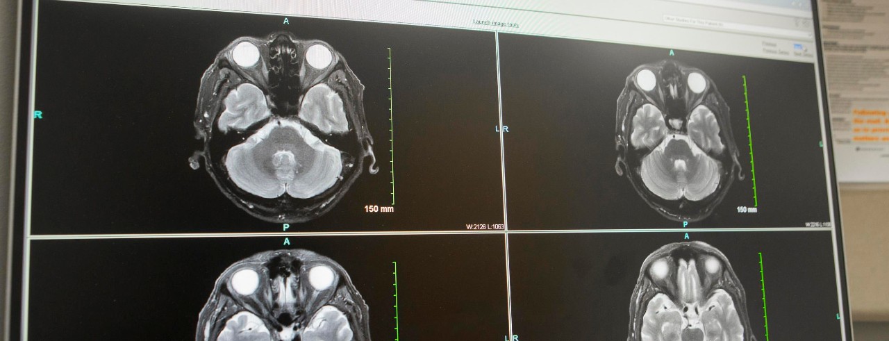 Brain scans on a computer monitor