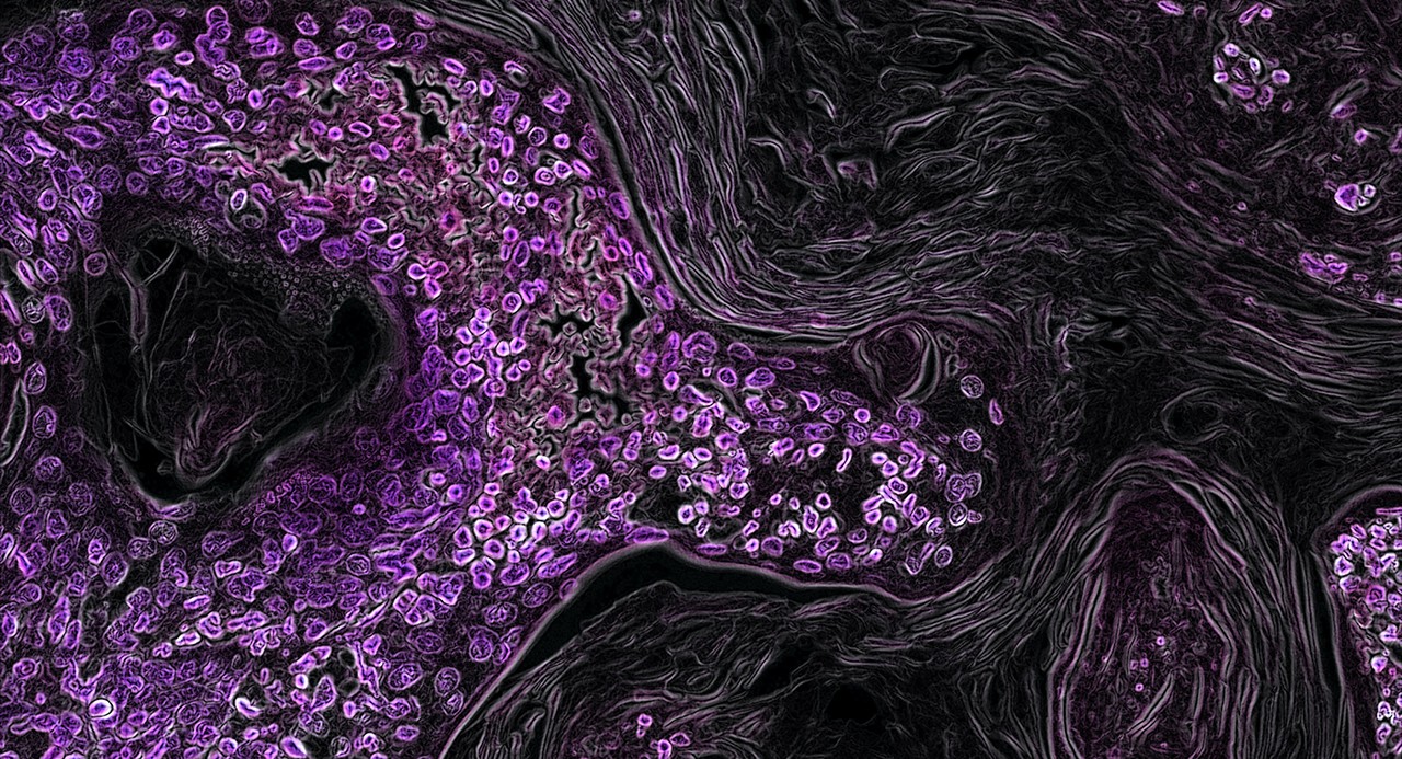 cancer cells
