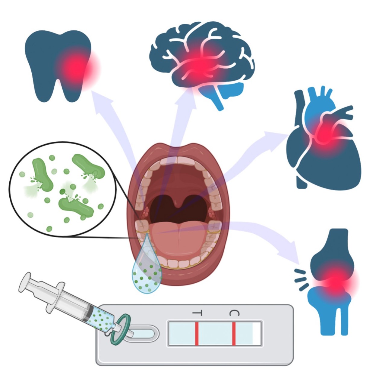 A graphic depicts an open mouth and bacteria, a tooth, brain, joint and heart that can be affected by periodontal disease and a syringe putting a sample in a home test.