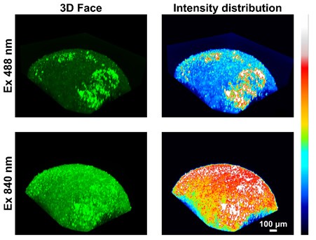Four squares each display a brain shape lit up in varying fluorescent green, blue, orange, yellow and red 