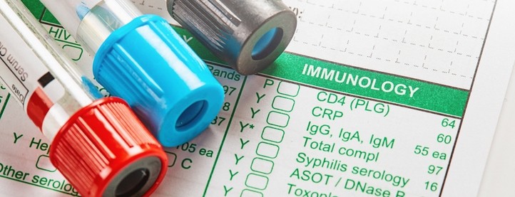 Three test tubes on top of a paper for blood testing of various diseases