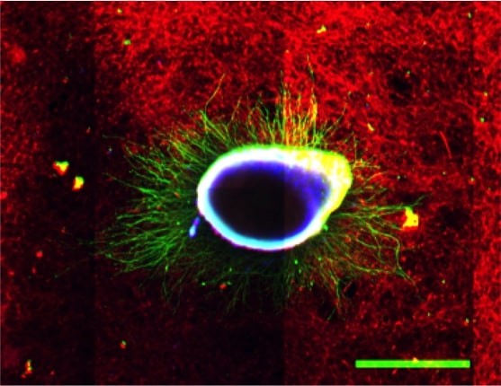 Image from Harris' nerve research