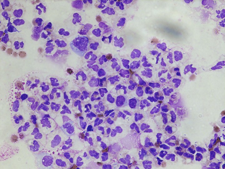 Menstrual fluid under a microscope 