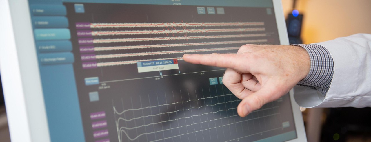 A doctor points his finger at a line on a monitor showing neurotrauma data