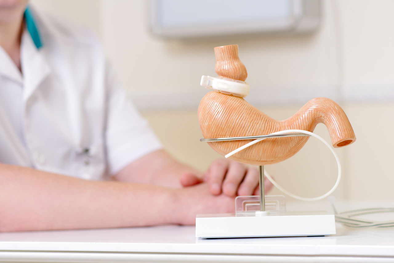 Band shown on replica stomach 3D model 
