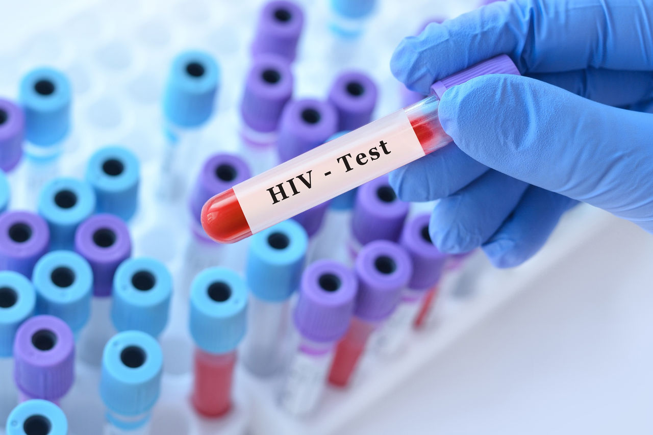 Gloved hand holding vial labeled HIV - Test above other vials