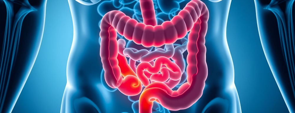 Crohn's disease causing inflammation in the digestive tract