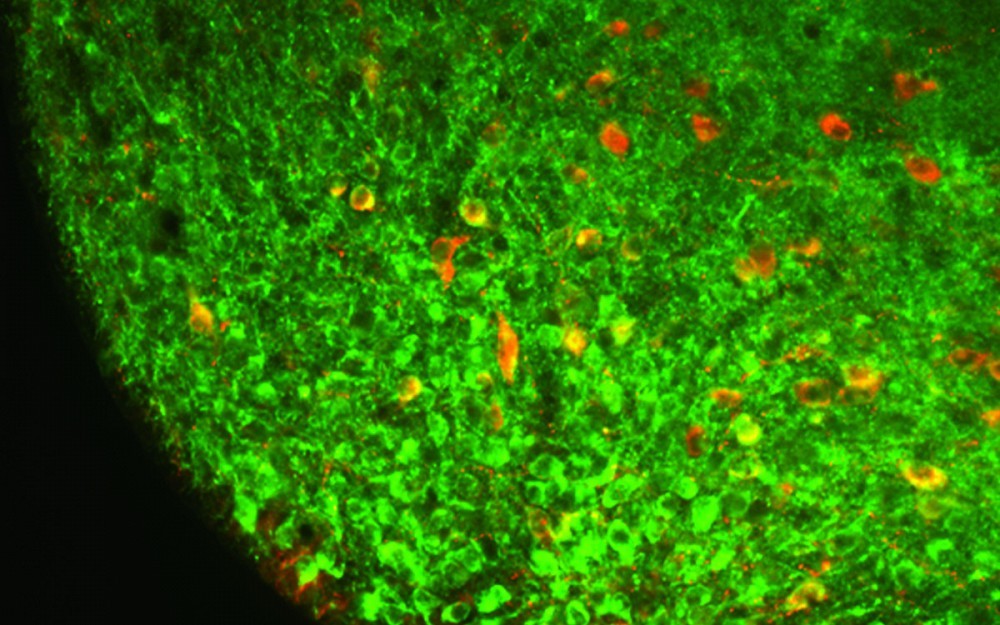 mTOR signaling in the hypothalamus 