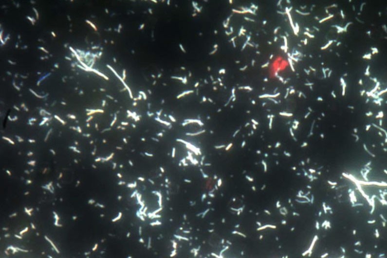 An image of the fluorescent microscopy of multi-wall carbon nanotubes-quantum dots  against a dark background.