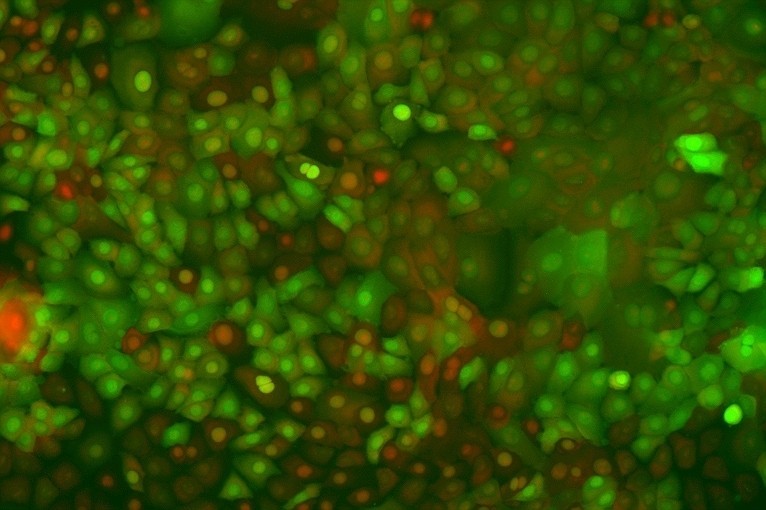 Dorothy Supp, PhD, has developed a modified skin cell that may help protect cultured skin substitutes from infection. 