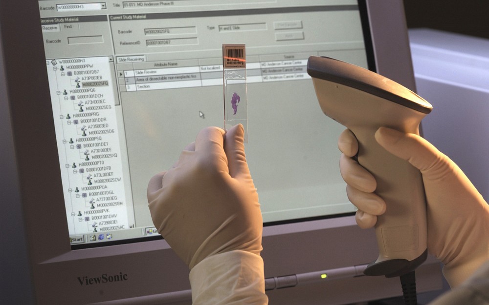Breast Cancer Scan