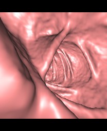 Radiologists can now use CT scanning technology to perform colorectal cancer screenings. 