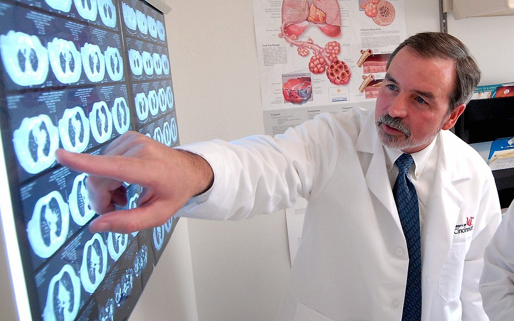 Lymphangioleiomyomatosis expert Frank McCormack, MD