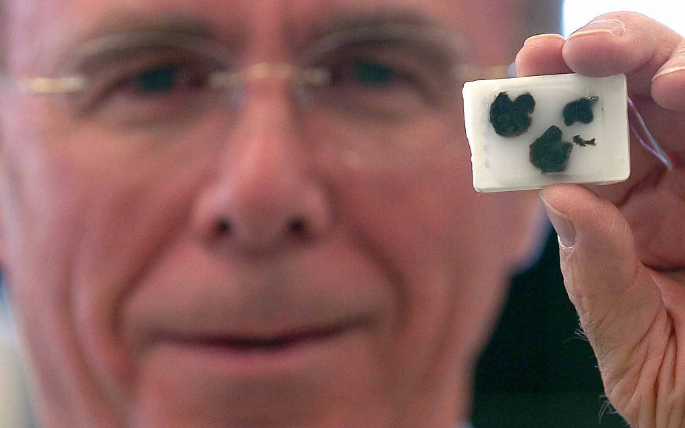 Marshall Anderson, PhD, shows non-cancerous lung tissue used in research.