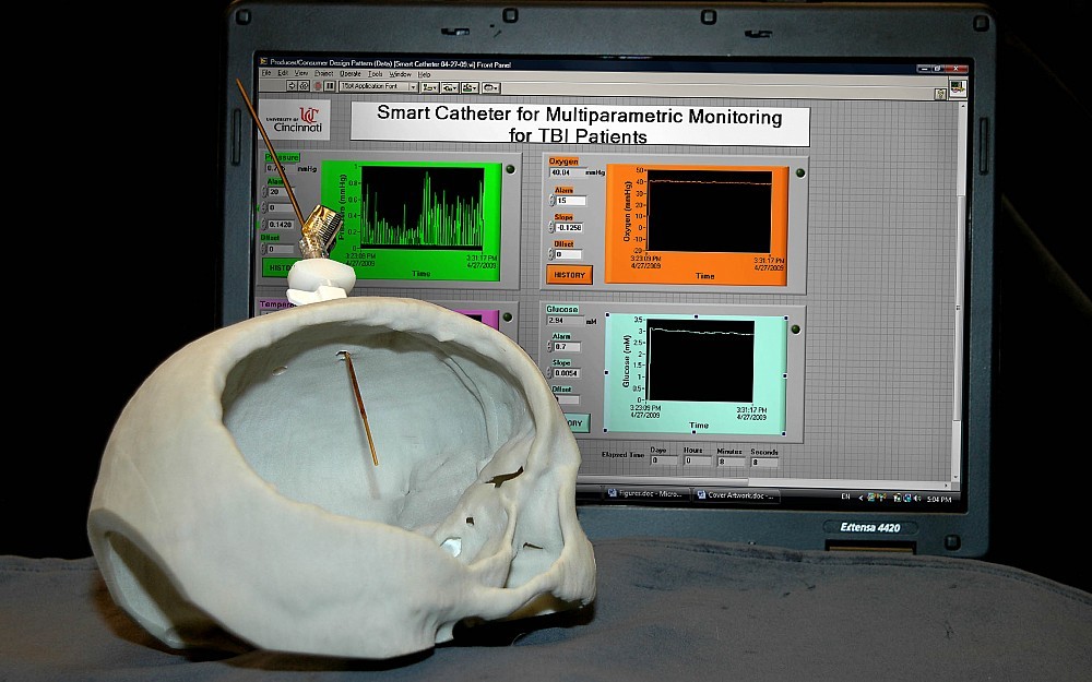 Smart Sensor for neurotrauma patients.