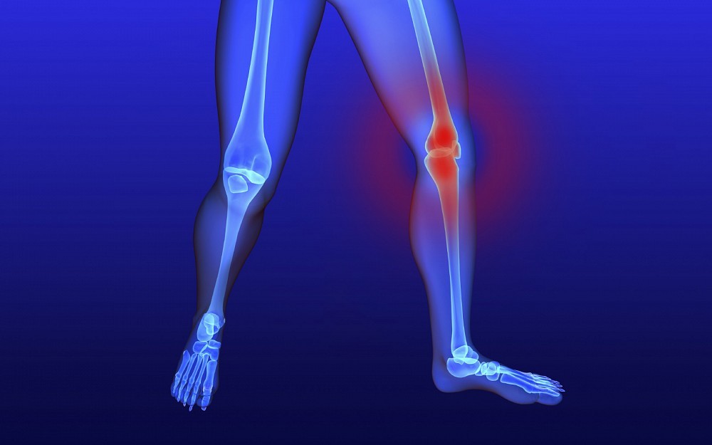 knee pain
