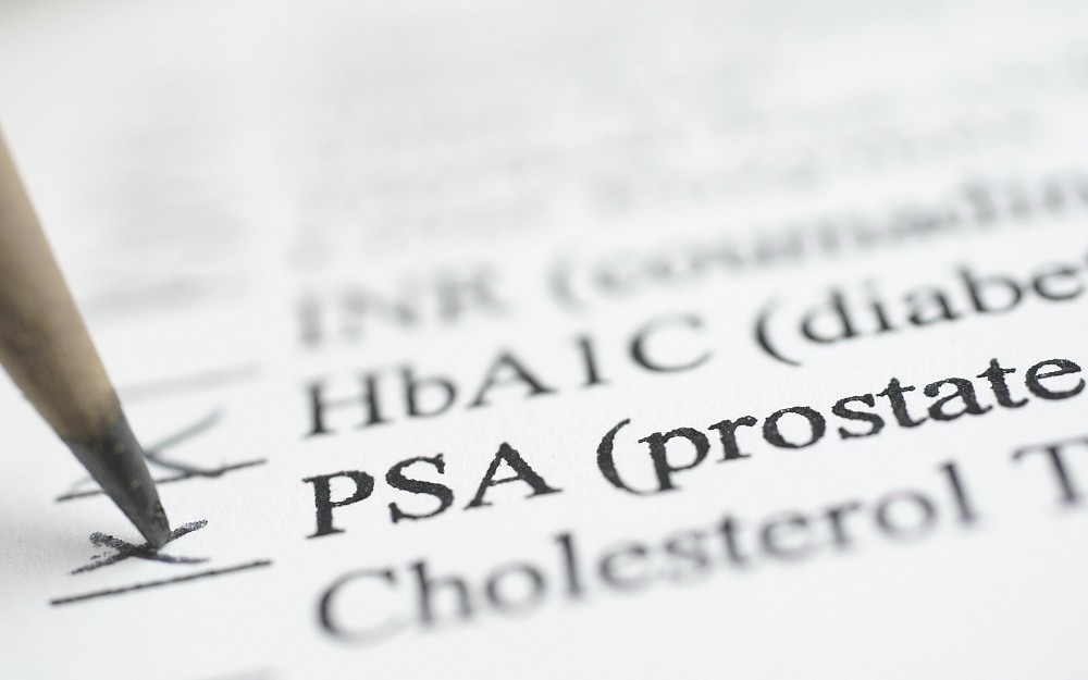 prostate specific antigen test