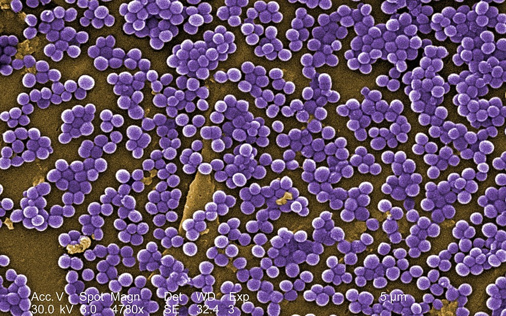 MRSA