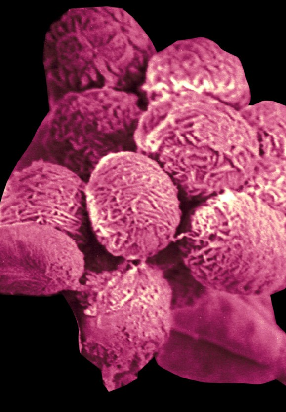Stachybotrys chartarum, a type of black mold, shown in magnification under electron microscope
