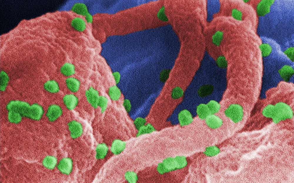 HIV (green) which co-cultivated with human lymphocytes