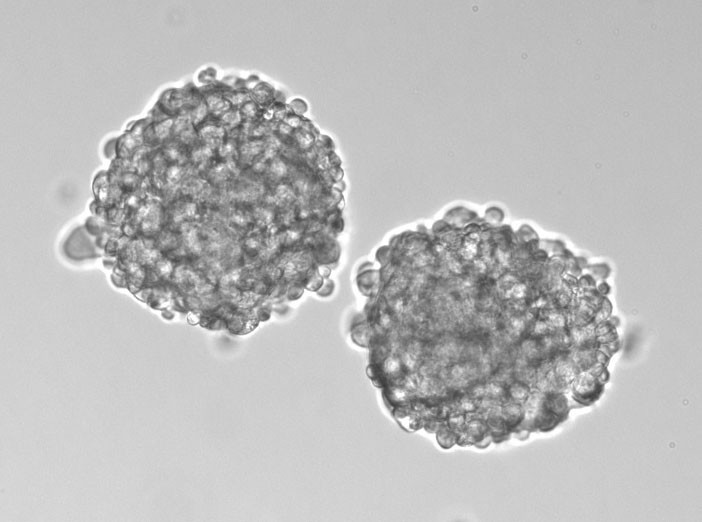 Lung cancer stem cells, grown via tumorsphere assay