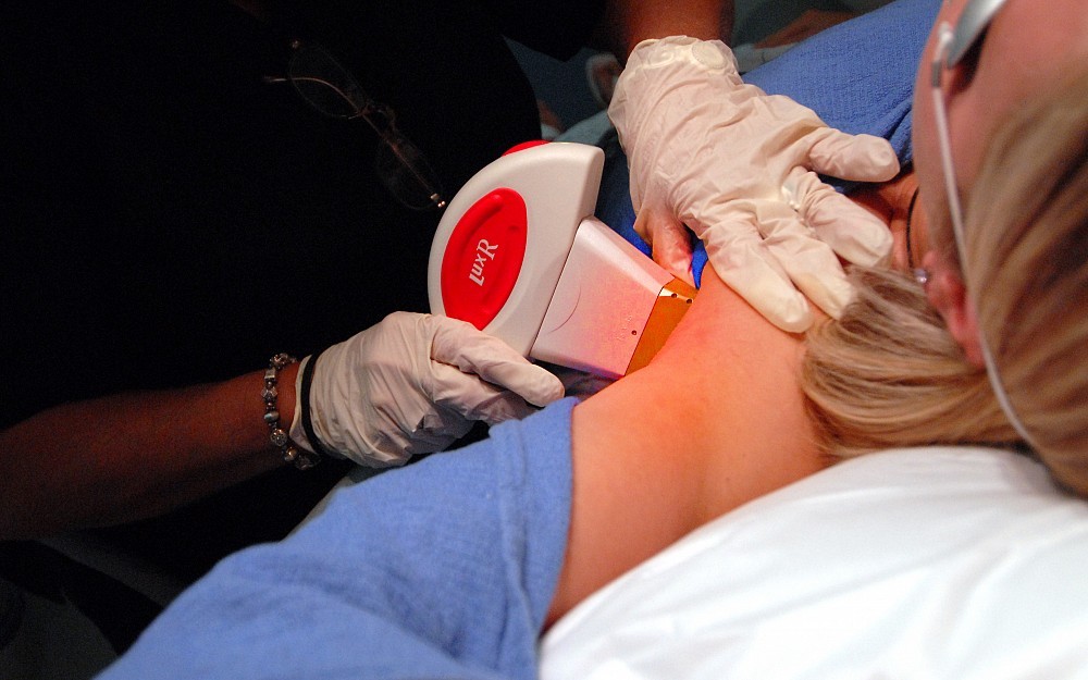 The StarLux system can be used for hair reduction. This is accomplished though concentrated pulses of light that create heat in the hair follicle. 