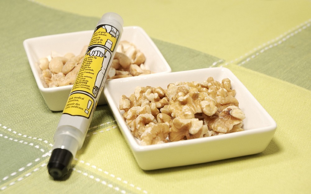 Food allergies are on the rise in adults.