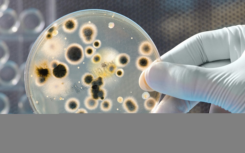 Bacteria in a petri dish.