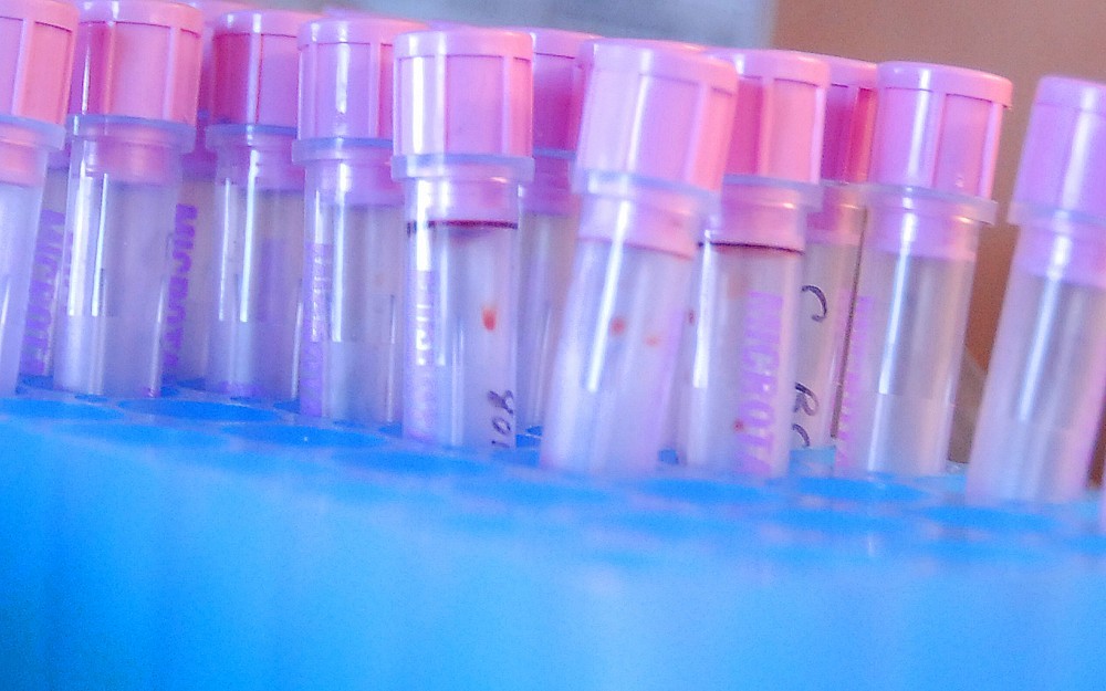 Vials