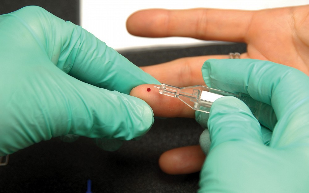 A hemoglobin AIC test is used to monitor blood sugar control. It is one of many outcomes measures being reported through PQRI. 