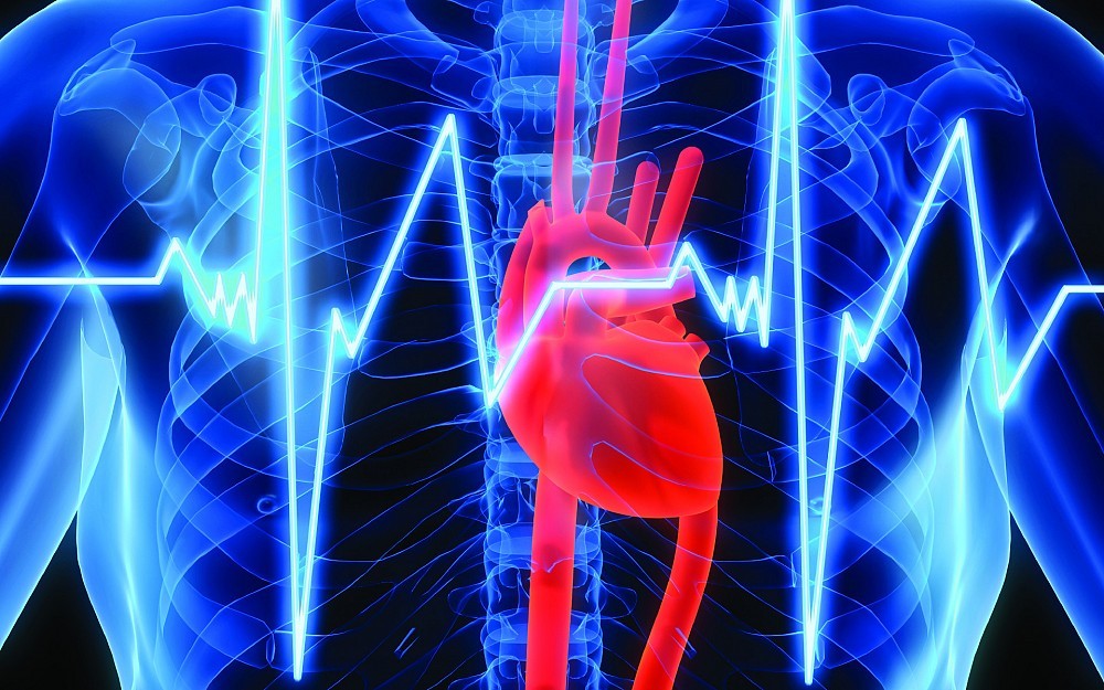 Heart Image
