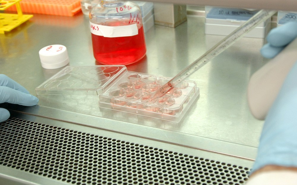 Four scientists from the University of Cincinnati (UC) Cancer Institute were recently awarded funding by local organizations to continue their research on ovarian, head and neck, and pancreatic cancers. 