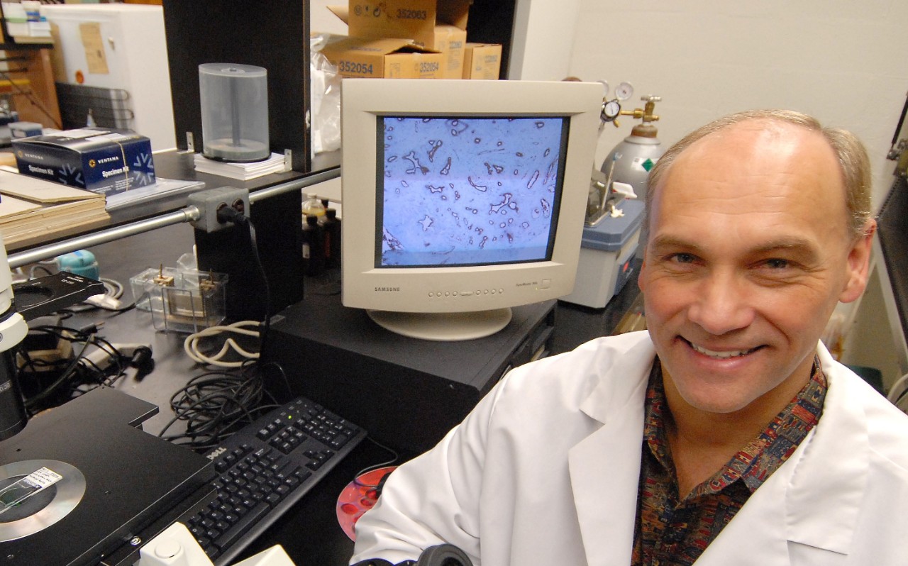Breast Cancer researcher Georg Weber, MD,PhD, in his lab coat in his lab with microscope 