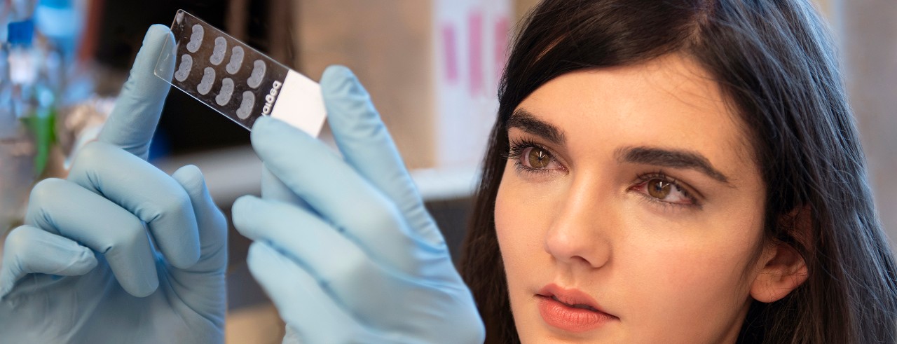 Christin Godale, neuroscience graduate student, looks at a slide sample in the Danzer lab at Cincinnati Children's