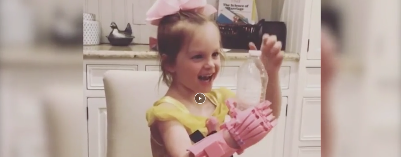 Four year old child tries out new prosthetic hand for first time