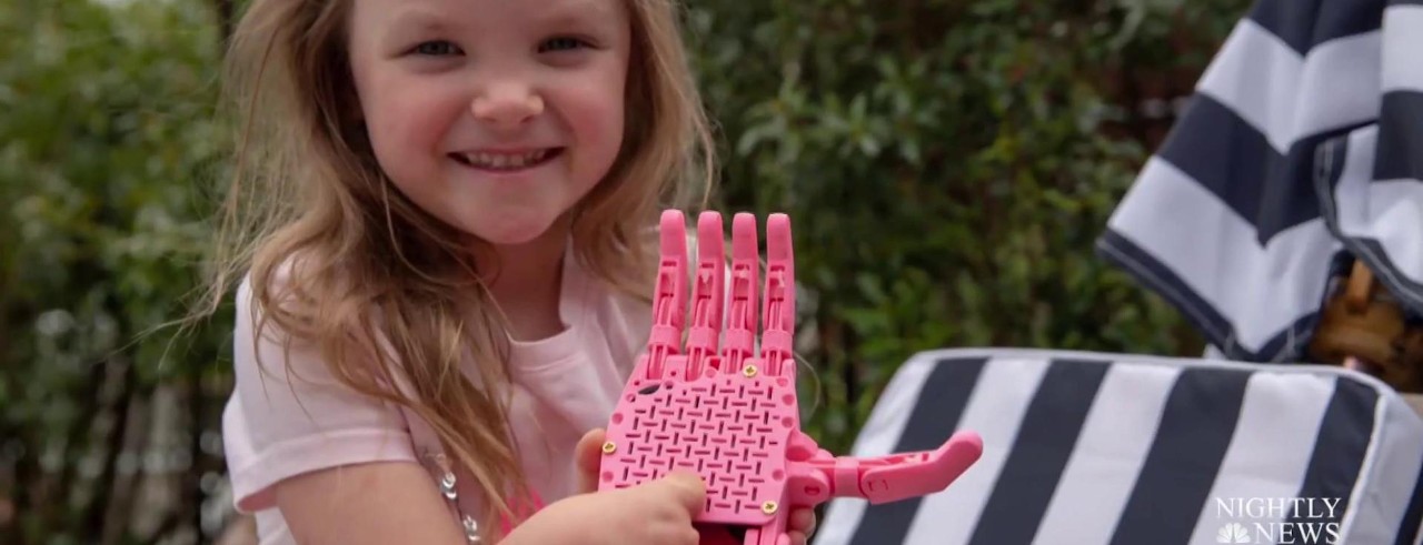 Little girl shows off pink prosthetic hand