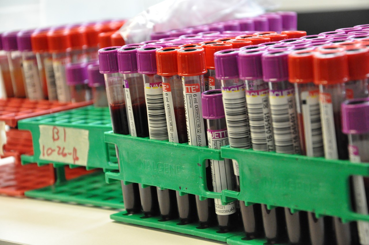 Testing vials of blood with purple and red caps