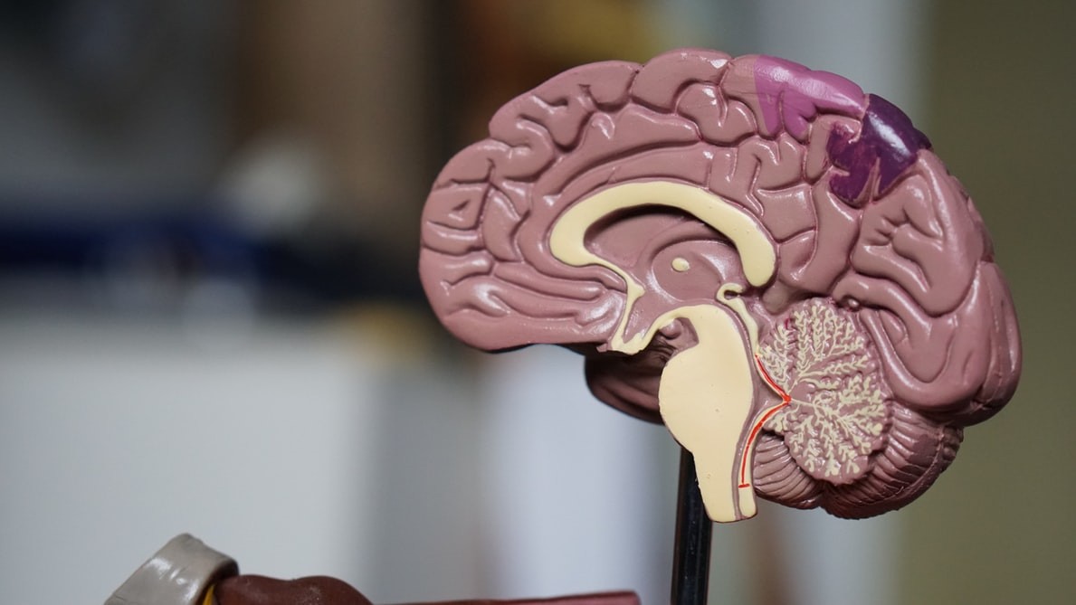 Medical model of brain