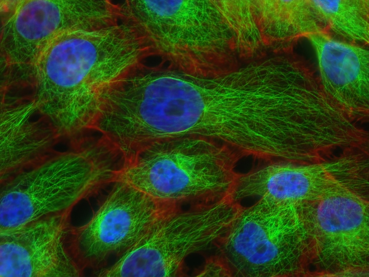 Human breast cancer cells