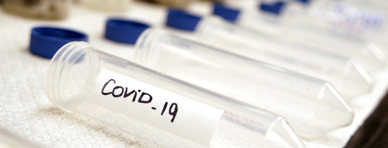 a row of open test tubes with the closest one labeled "COVID-19"