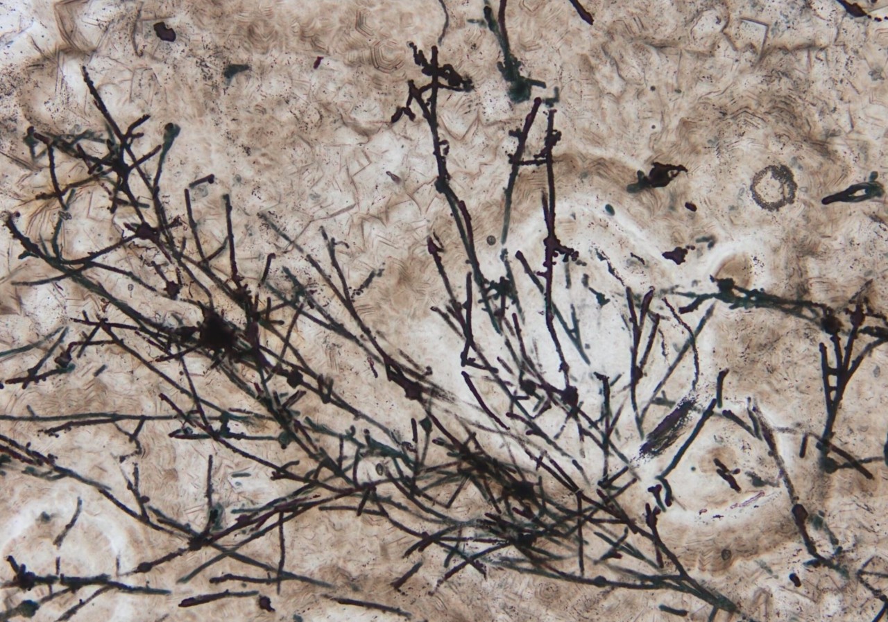 A 650-million-year-old fossil of fungus. 