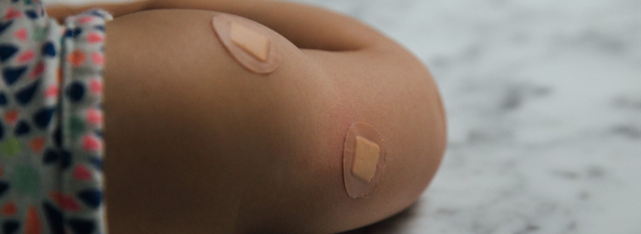 child's arm with band-aids