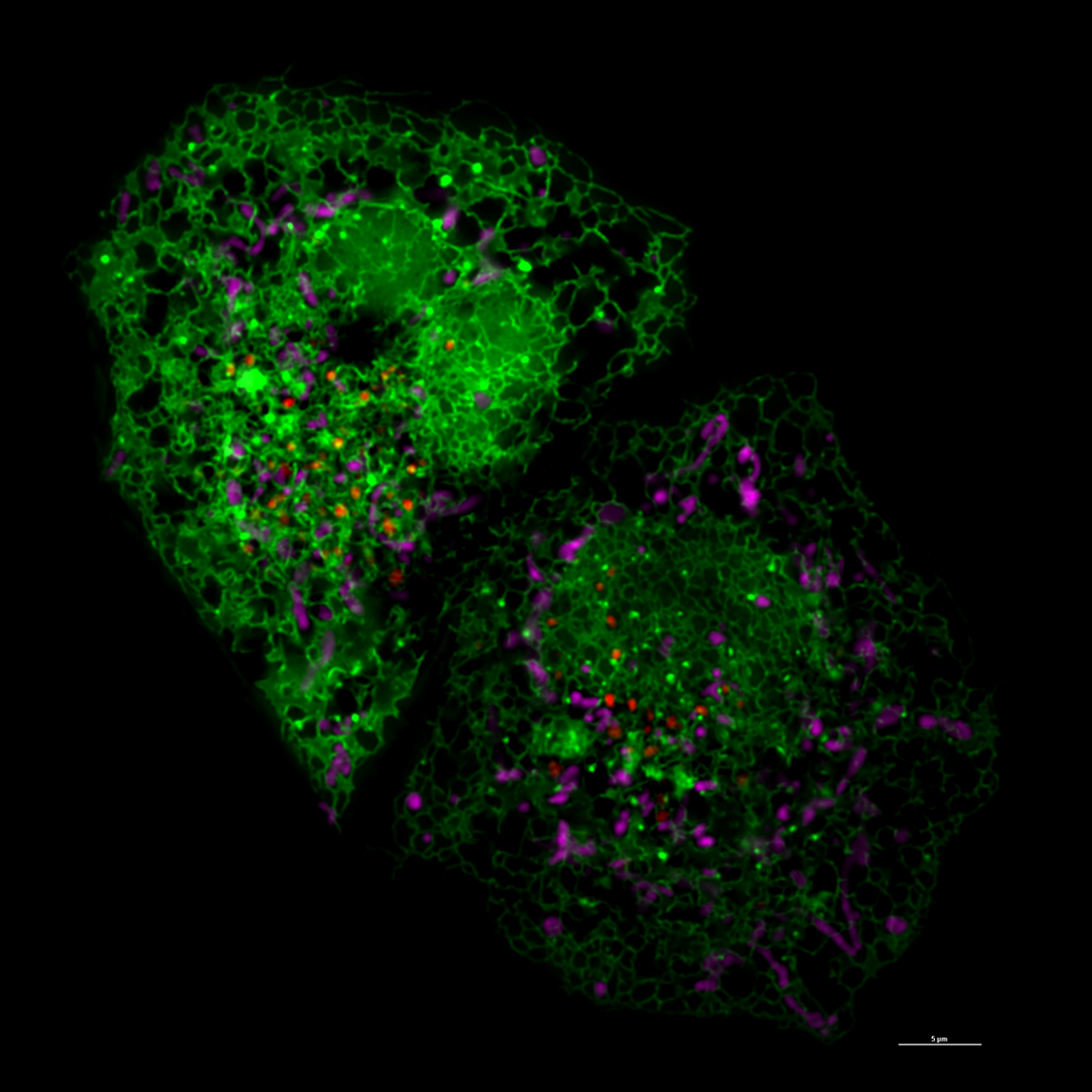 A super resolution image of a human cell