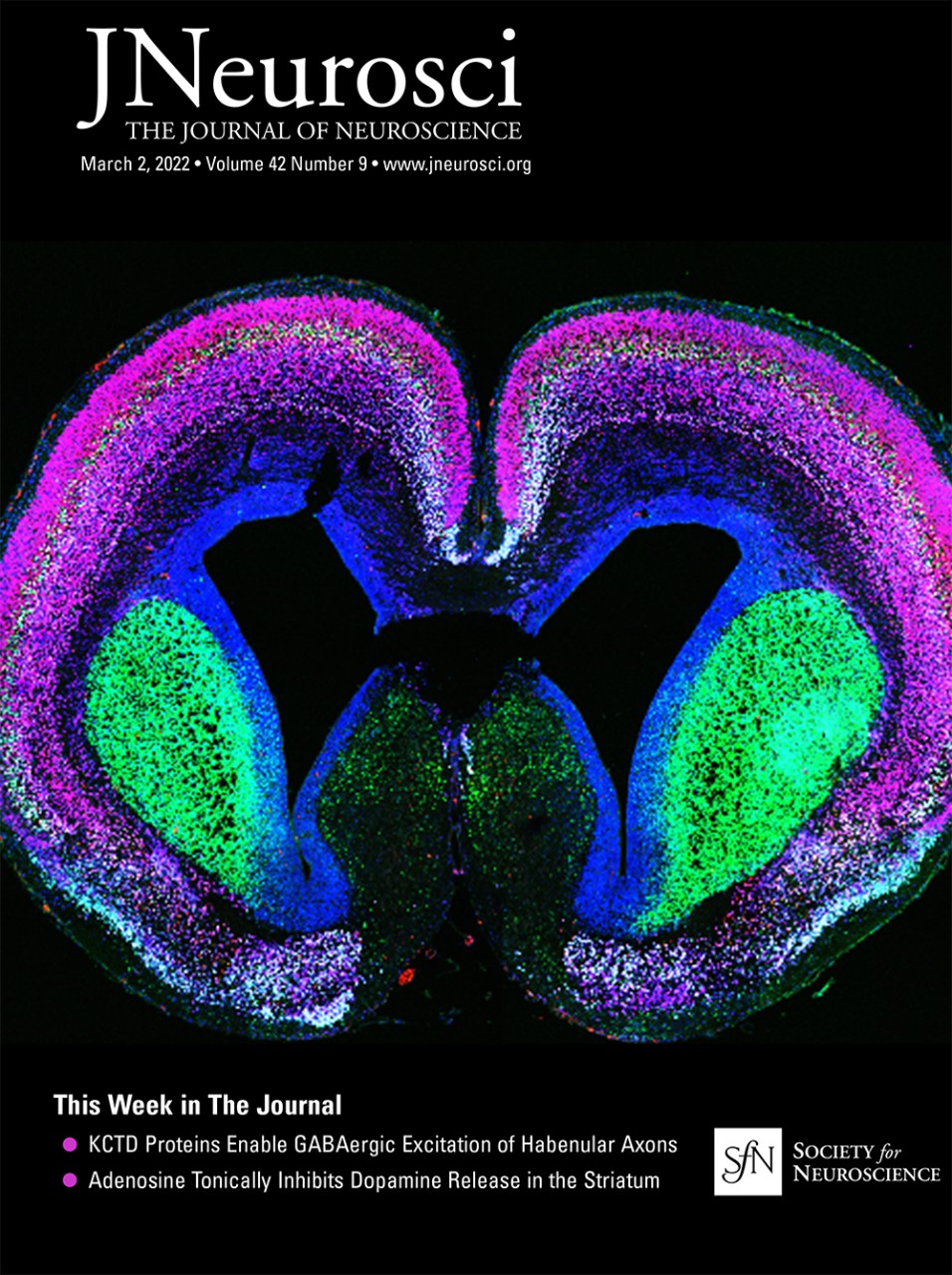 cover featuring brain image