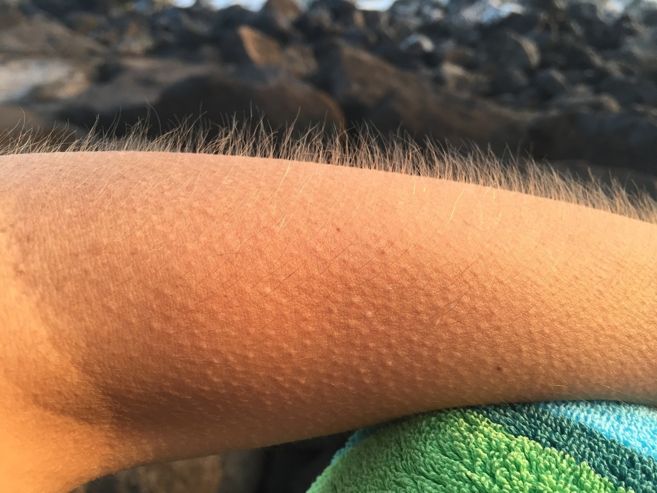 a photo of someone's arm with goosebumps