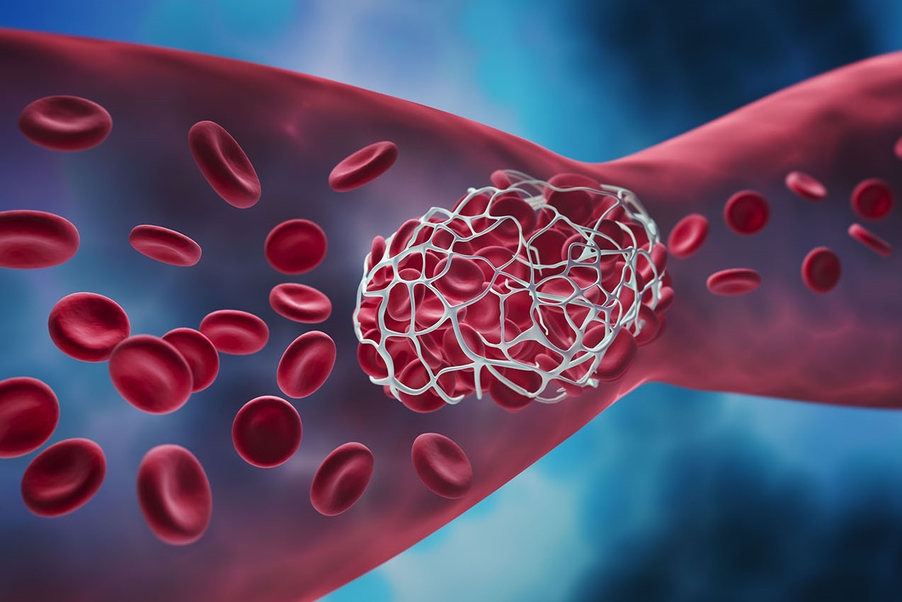 A depiction of anticoagulant drugs impacting blood clots